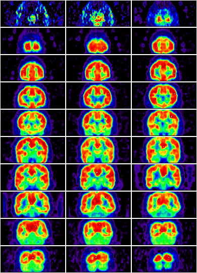 Sections Of The Brain. sections of the brain.