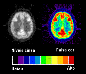 [N�veis de cinza e cor em imagem PET]