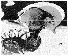 Cirurgia estereot�xica: atlas cerebral
